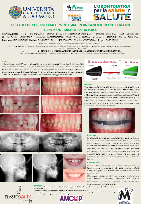 L’uso del Dispositivo AMCOP S INTEGRAL in un Paziente in Crescita con Dentizione Mista